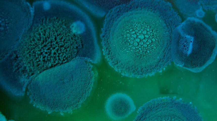 Bilim insanları alarma geçti! Ölümcül mantar milyonlarca insanı öldürebilir! Akıllara o popüler dizi geldi...