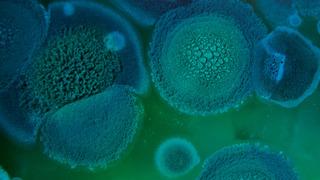 Bilim insanları alarma geçti! Ölümcül mantar milyonlarca insanı öldürebilir! Akıllara o popüler dizi geldi...