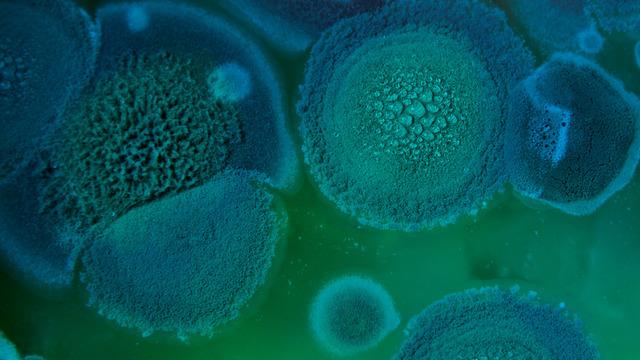 Bilim insanları alarma geçti! Ölümcül mantar milyonlarca insanı öldürebilir! Akıllara o popüler dizi geldi...