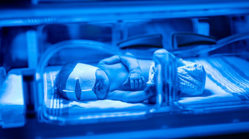 Yenidoğan bebeklerin yüzde 80'inde görülüyor: Sarılık olan bebeğe 'şekerli su vermeyin' uyarısı! Yenidoğan sarılığı ne zaman tehlikeli hale gelir?