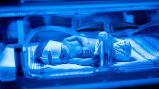 Yenidoğan bebeklerin yüzde 80'inde görülüyor: Sarılık olan bebeğe 'şekerli su vermeyin' uyarısı! Yenidoğan sarılığı ne zaman tehlikeli hale gelir?