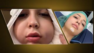 Bir filtre kadar kolay değil! Bişektomi ameliyatı yaptıran kadın neler yaşadı? Sosyal medyada çok konuşuldu…