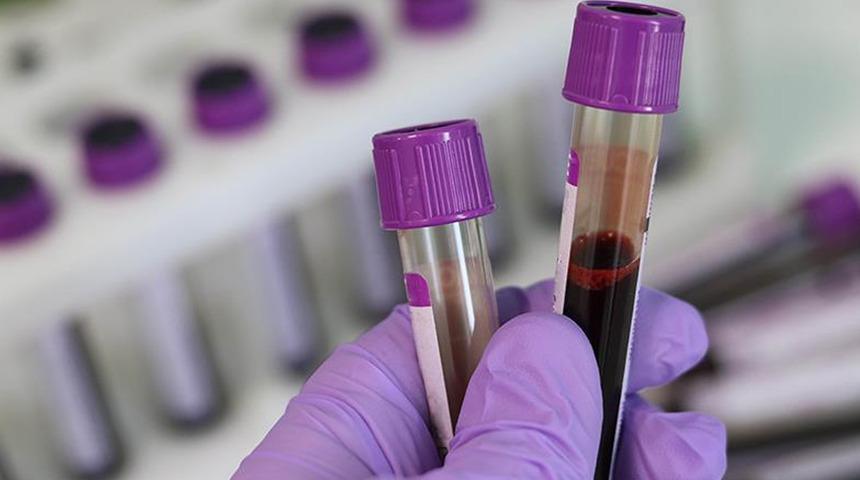 Genetik tehlike... Evlenmeden önce test şart: Talasemi sessizce yayılıyor! Uzmanlar uyardı: "Talasemi taşıyıcılık oranı yüzde 2,1"