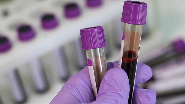 Genetik tehlike... Evlenmeden önce test şart: Talasemi sessizce yayılıyor! Uzmanlar uyardı: Talasemi taşıyıcılık oranı yüzde 2,1