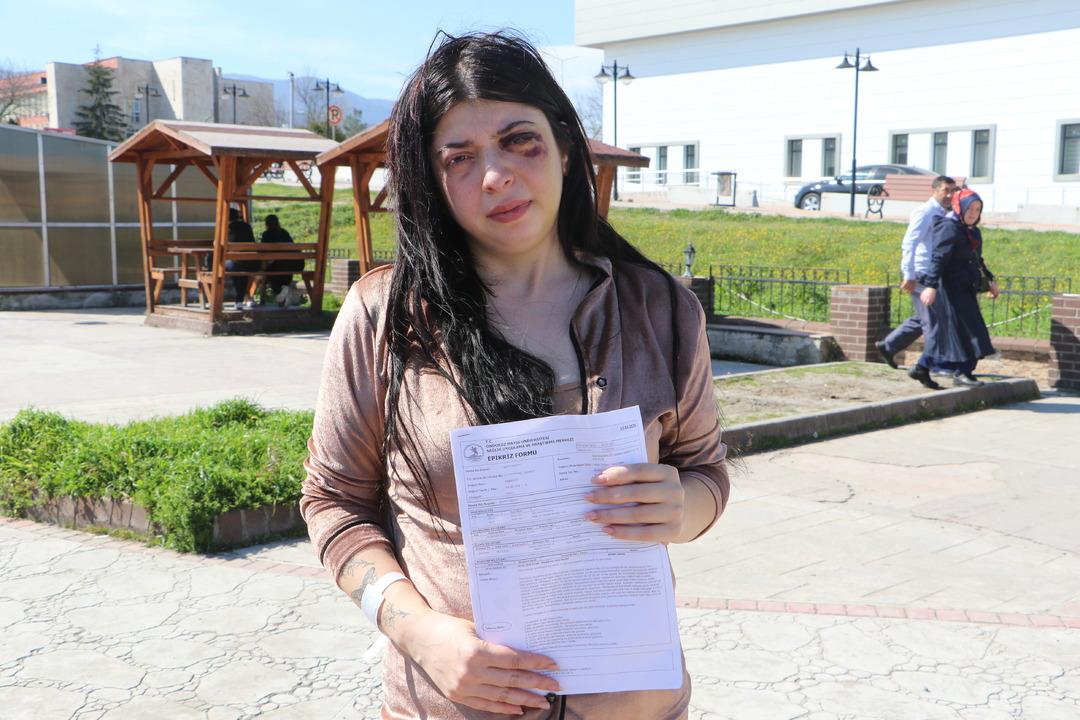 SOKAK-ORTASINDA-DARBEDILEN-DAMLA-PLATIN_708054_209480