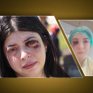 Yolda yürürken önce sözlü taciz sonra darp skandalı! 'Yüzümde bir demirle yaşamaya mahkum bırakıldım'