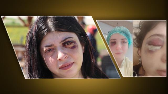 Yolda yürürken önce sözlü taciz sonra darp skandalı! 'Yüzümde bir demirle yaşamaya mahkum bırakıldım'