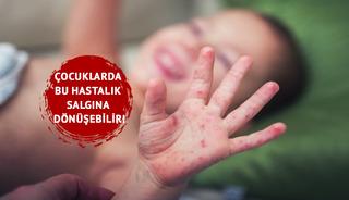 Çocuklarda bu hastalık salgına dönüşebilir!