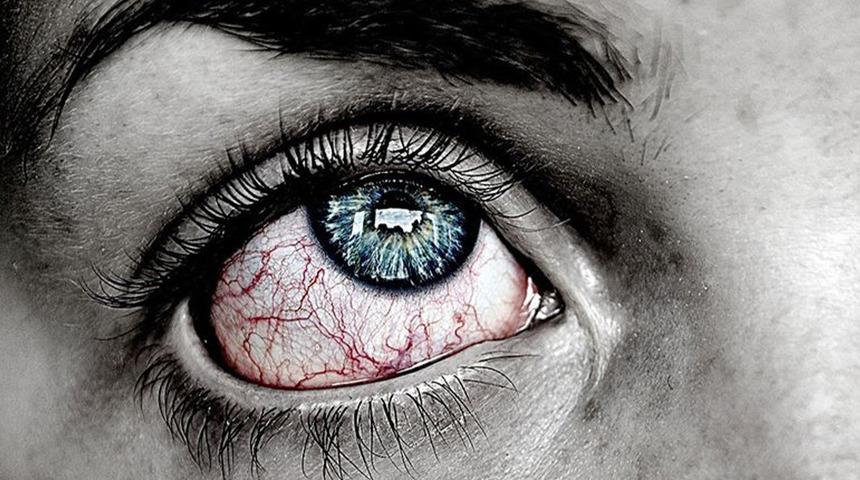 Göz sağlığında sessiz tehlike... Sarı nokta kör ediyor! Uzmanlar uyardı: "Bu belirtileri yaşıyorsanız vakit kaybetmeyin"