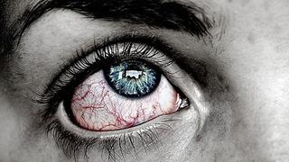 Göz sağlığında sessiz tehlike... Sarı nokta kör ediyor! Uzmanlar uyardı: Bu belirtileri yaşıyorsanız vakit kaybetmeyin