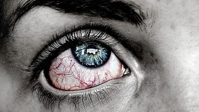 Göz sağlığında sessiz tehlike... Sarı nokta kör ediyor! Uzmanlar uyardı: Bu belirtileri yaşıyorsanız vakit kaybetmeyin