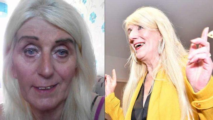 Piyangodan çıkan parayı estetiğe yatırdı G1