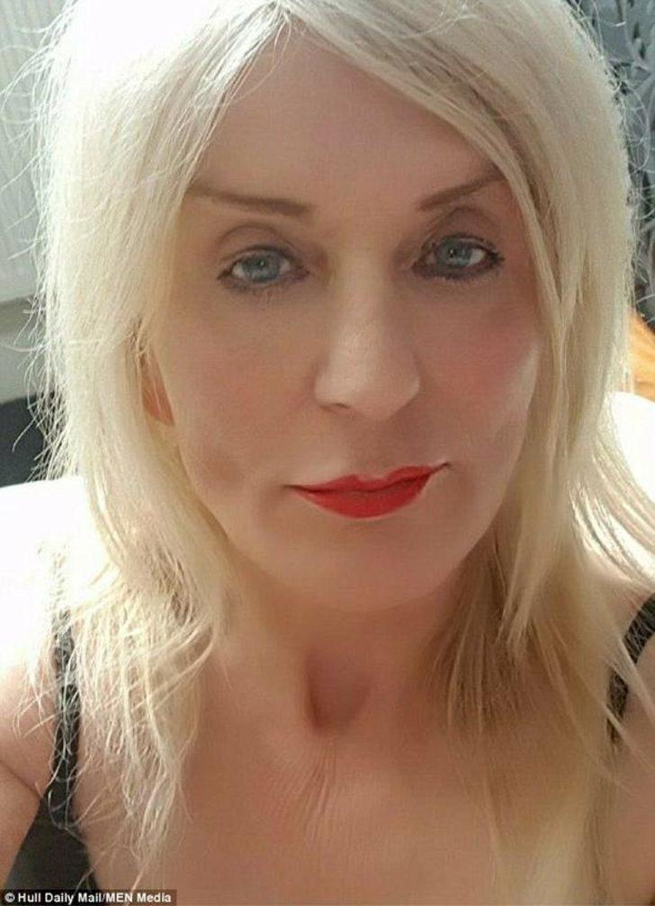 Piyangodan çıkan parayı estetiğe yatırdı G2