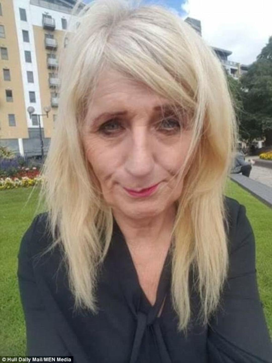 Piyangodan &ccedil;ıkan parayı estetiğe yatırdı