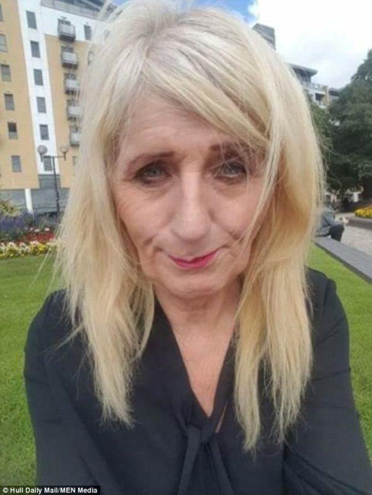 Piyangodan çıkan parayı estetiğe yatırdı G3