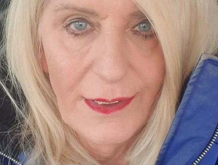 Piyangodan çıkan parayı estetiğe yatırdı G4