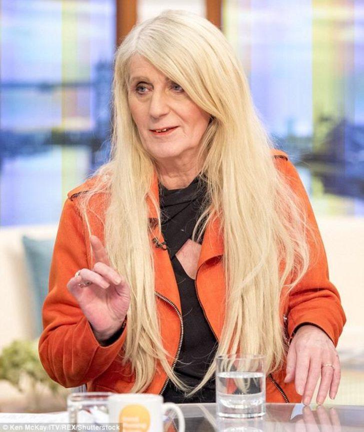 Piyangodan çıkan parayı estetiğe yatırdı G5