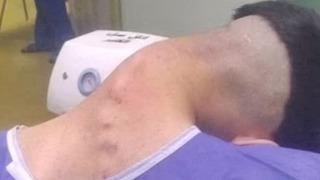 Akılalmaz olay! Boynu taşıyamadı başı düştü