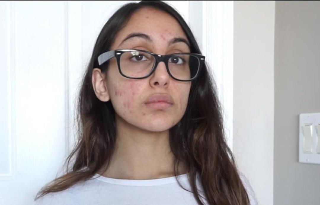 Sosyal medya fenomeni Sunna'nın değişimi şaşırttı