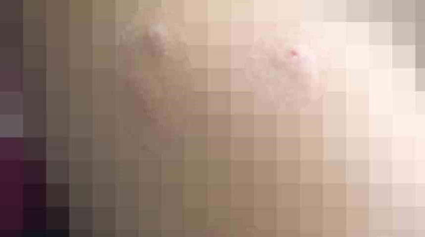 Sokak köpeği 5 yaşındaki çocuğa saldırdı