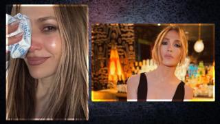  Jennifer Lopez provalarda yaralandı! Buz torbasını kaldırıp gösterdi