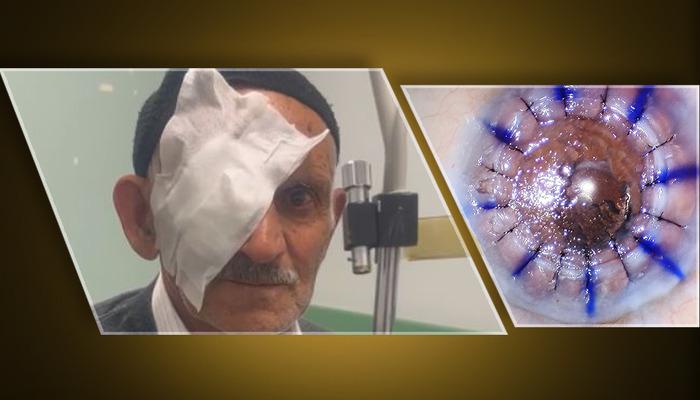 Nakille gelen ışık... 10 yıldır kornea nakli bekleyen 83 yaşındaki hasta: "Gözümü sen açtın"
