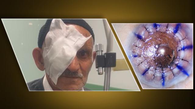 Nakille gelen ışık... 10 yıldır kornea nakli bekleyen 83 yaşındaki hasta: Gözümü sen açtın