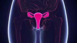 Miyomlar kısırlığa neden olur mu?