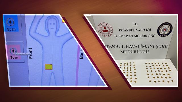 Yer: İstanbul Havalimanı! X-ray, kadınların cinsel organlarında yoğunluk tespit etti... Gerçek şaşkına çeviriyor!