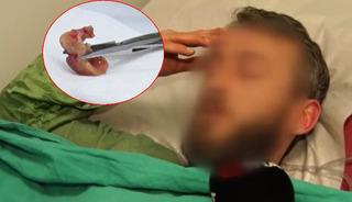 Uykusundan dayanılmaz öksürükle uyandı, aynaya bakınca şok oldu!