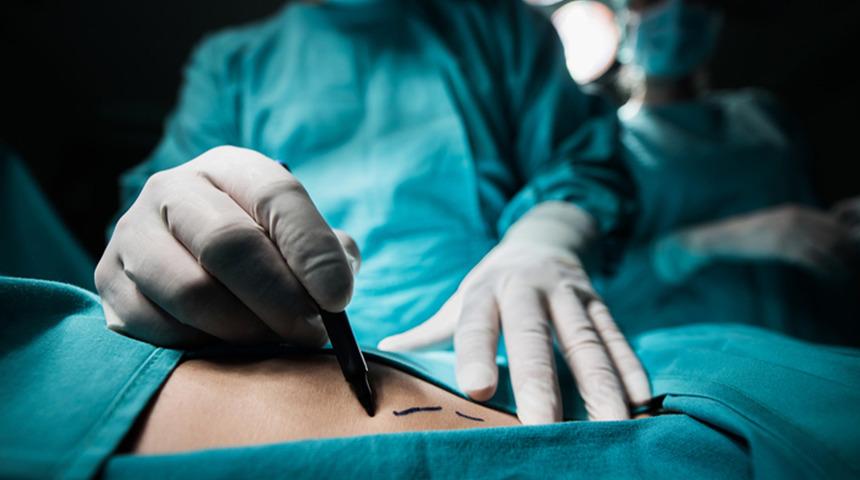 Yaz öncesi estetikte zirvede: Fazla yağlara veda zamanı! Liposuction kimlere yapılmaz? Uzmanlar uyarıyor: "Havalar çok ısınmadan yaptırılmalı"