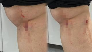 Üniversite kampüsünde köpeklerin saldırına uğradı: O anlar kamerada 