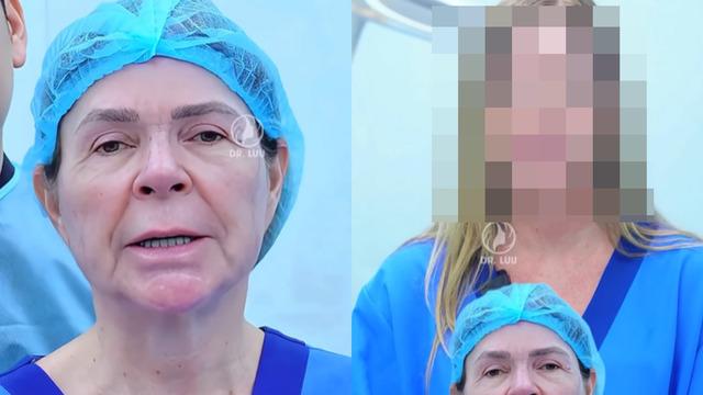 Estetikle 30 yaş gençleşti! Yaşlı kadının yeni halini görenler şaştı kaldı!