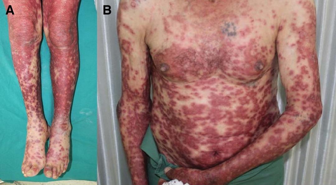derm.2022.0032_figure1
