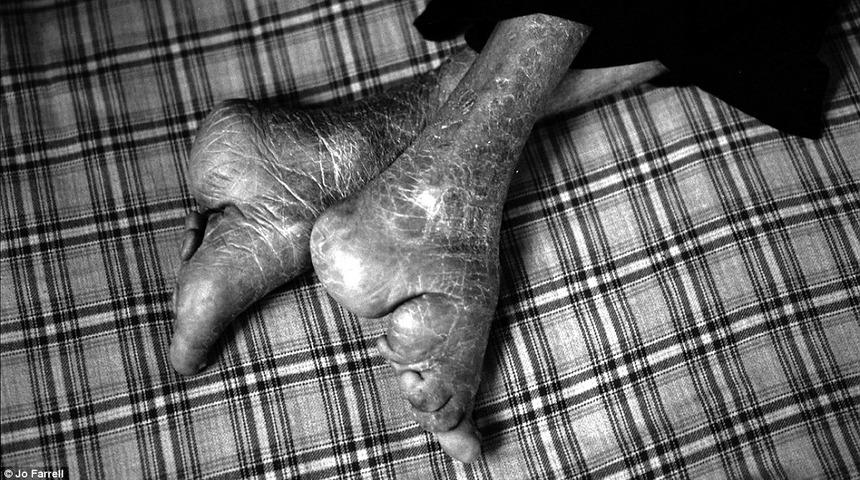 Bir zamanların g&uuml;zellik sembol&uuml;: Lotus ayaklar