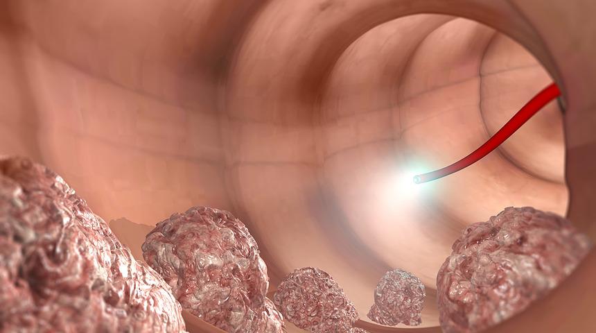 Uzun süren ishalin 10 nedeni!