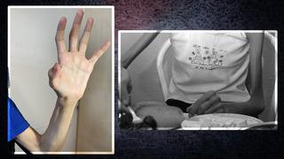 Sessiz bir salgın gibi yayılıyor! Ergenlerde anoreksiyaya dikkat! Uzmanlar uyarıyor: Acile bayılmayla gelen anoreksiya olduğunu anladığımız hastalar var