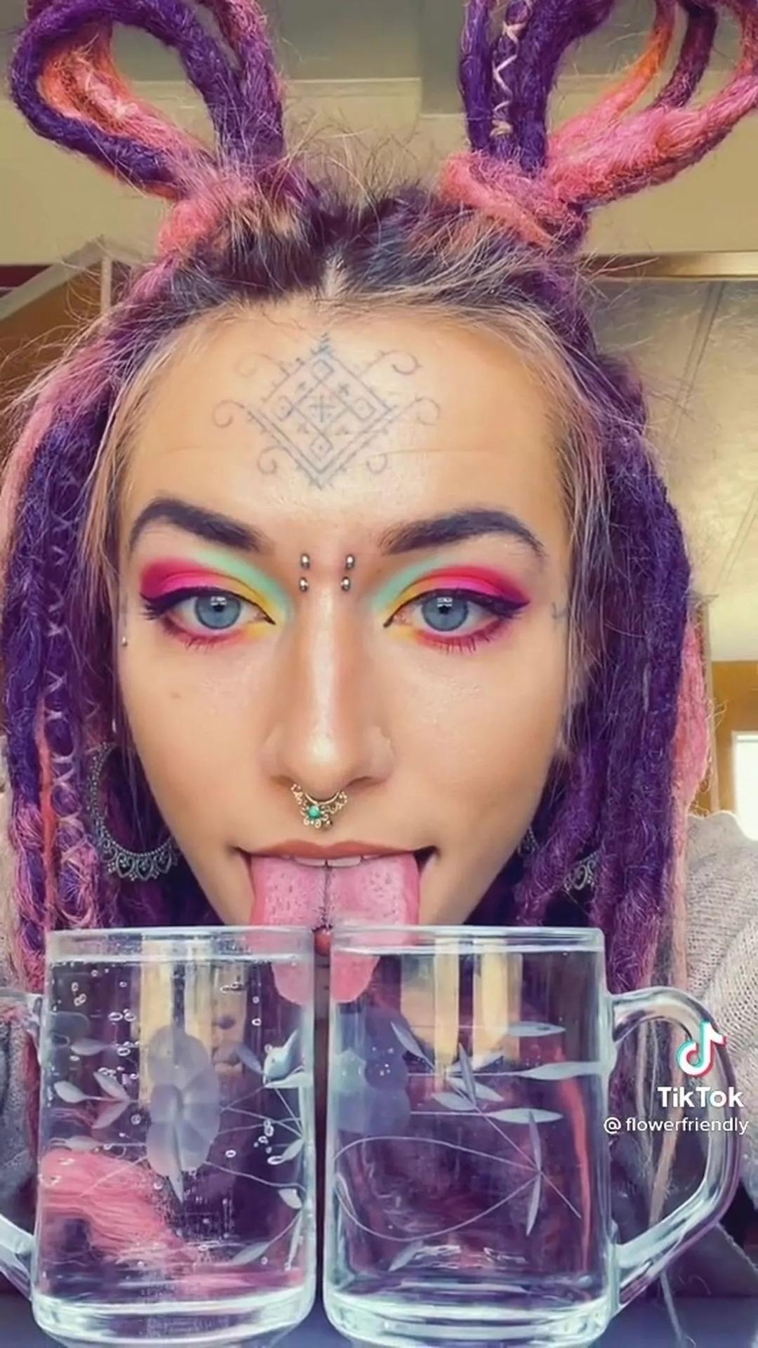 Dilini ortadan ikiye böldü! Heves uğruna hayatı mahvoluyordu! Şimdi konuşmayı yeniden öğreniyor 3