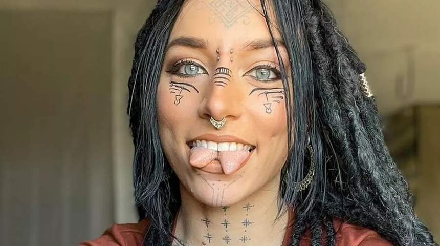 Dilini ortadan ikiye böldü! Heves uğruna hayatı mahvoluyordu! Şimdi konuşmayı yeniden öğreniyor