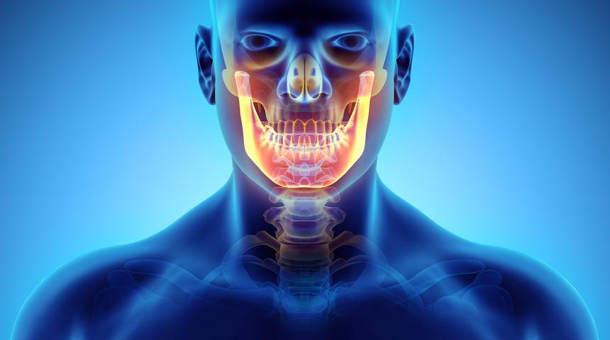 Hayvan kemiğinden yapay çene kemiği