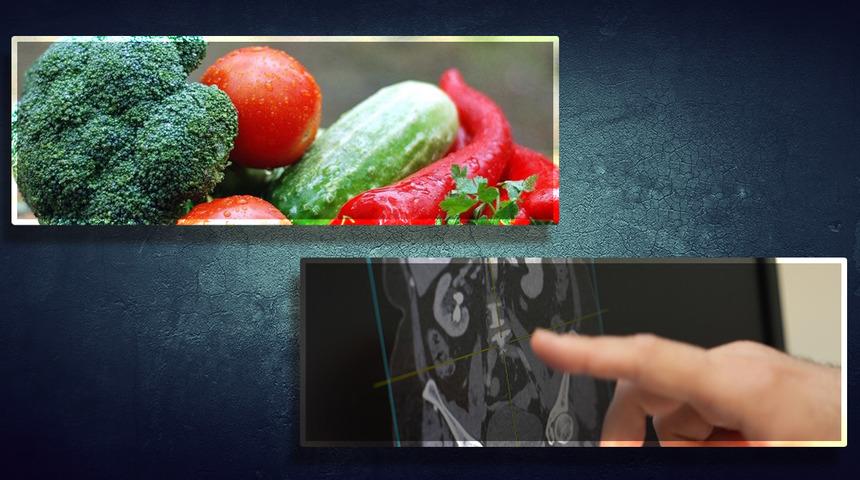 Cinsel sağlık için önemli olan ilk adım: Yediklerinizi gözden geçirin! 