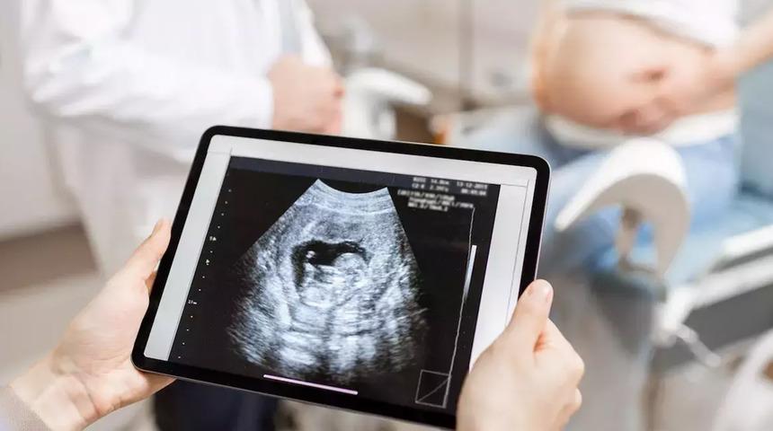 Son teknolojiyle gelen mucize! Anne baba adayları müjde: 4D ultrason ile anne karnında, bebeklerin gülüşü görülebilecek...