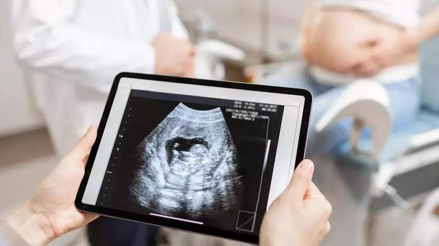 Son teknolojiyle gelen mucize! Anne baba adayları müjde: 4D ultrason ile anne karnında, bebeklerin gülüşü görülebilecek...