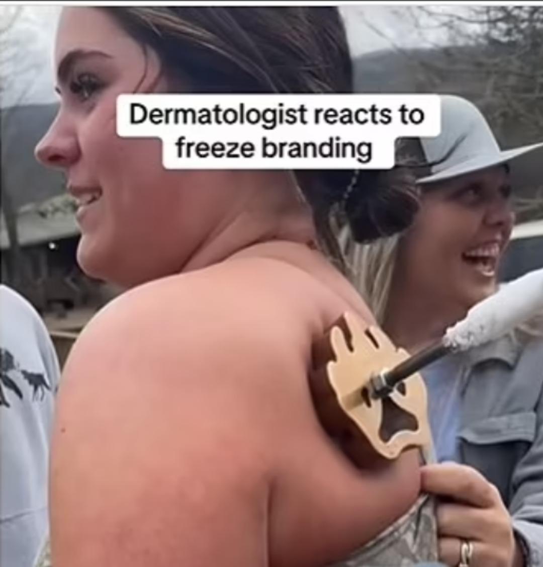 Yeni estetik trendi tehlike saçıyor! Vücutlarına damgalama yapıyorlar ama bakın sonucu ne oluyor! 1