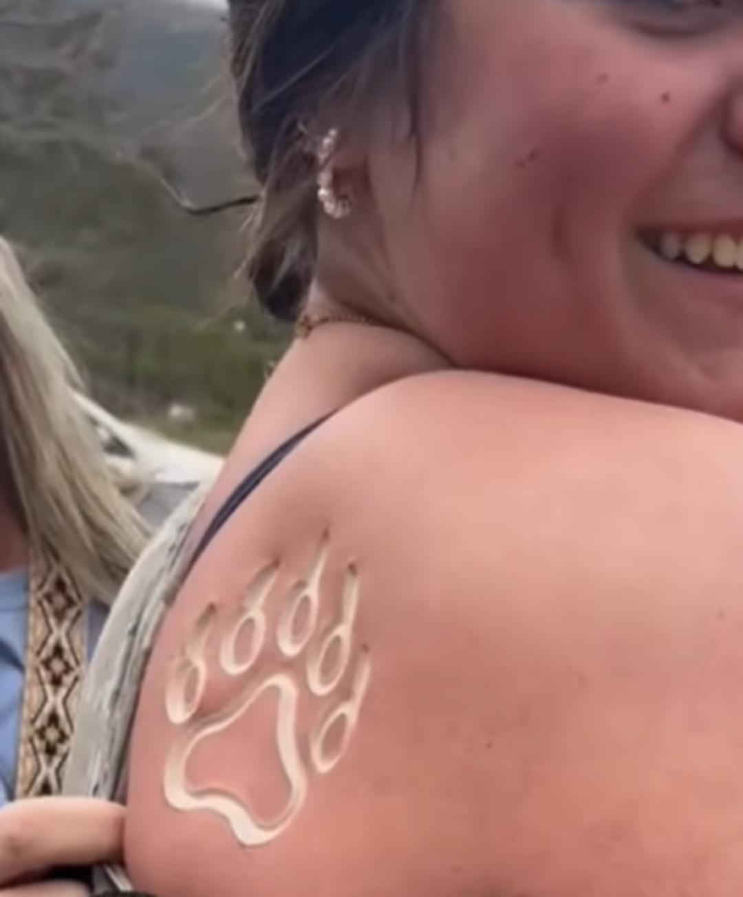 Yeni estetik trendi tehlike saçıyor! Vücutlarına damgalama yapıyorlar ama bakın sonucu ne oluyor! 3