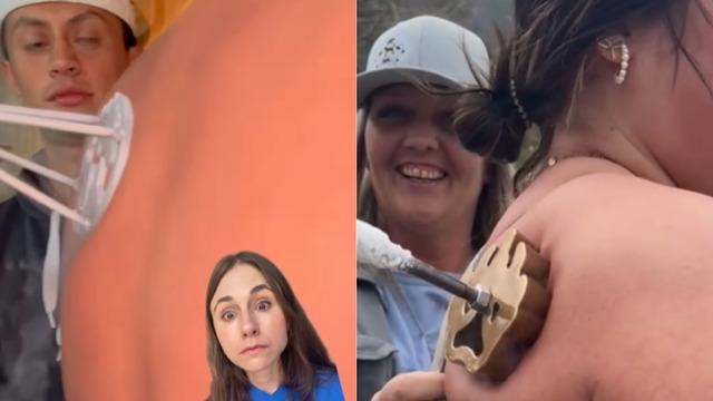 Yeni estetik trendi tehlike saçıyor! Vücutlarına damgalama yapıyorlar ama bakın sonucu ne oluyor! 