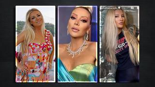 9 saat süren estetik operasyon! Gülşah Saraçoğlu yüzünün son halini paylaştı