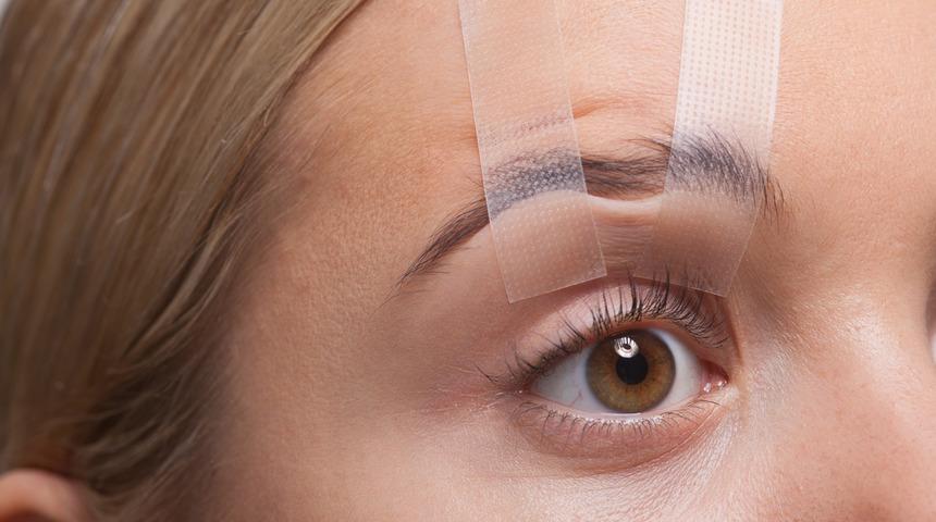 Göz estetiği ameliyatları nedir, nasıl yapılır ve neden gereklidir?