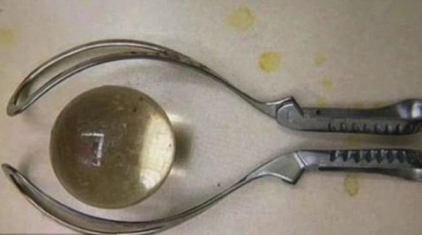 Eğlence için anüsüne soktuğu cam top başına bela oldu!