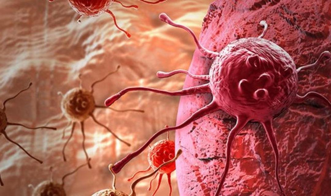 Bir anda karar verip solaryuma girdi! O günden sonra hayatı karardı! Yaşam savaşı veriyor... 4